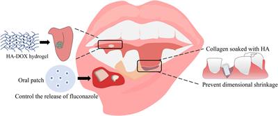 The applications of polysaccharides in dentistry